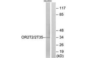 Western blot analysis of extracts from HuvEc cells, using OR2T2/2T35 Antibody. (OR2T2/2T35 抗体  (AA 201-250))