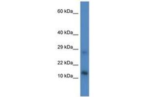 Image no. 1 for anti-LYR Motif Containing 4 (LYRM4) (AA 33-82) antibody (ABIN6746508) (LYRM4 抗体  (AA 33-82))
