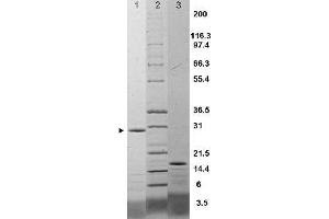 IL-17F Rat Recombinant Protein - SDS-PAGE. (IL17F 蛋白)