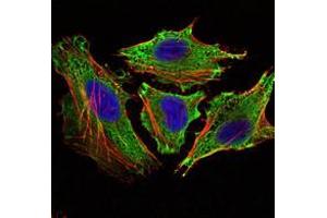 Immunofluorescence (IF) image for anti-Signal Transducer and Activator of Transcription 6, Interleukin-4 Induced (STAT6) antibody (ABIN969423)