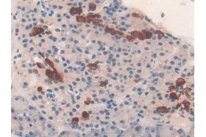 Detection of TUBd in Mouse Pancreas Tissue using Polyclonal Antibody to Tubulin Delta (TUBd) (TUBD1 抗体  (AA 236-455))