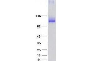 VPS53 Protein (Transcript Variant 1) (Myc-DYKDDDDK Tag)