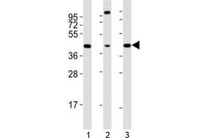 Western blot testing of Sox17 antibody at 1:2000 dilution. (SOX17 抗体  (AA 350-400))