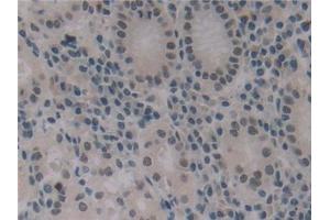 Detection of IGFBP1 in Human Stomach Tissue using Polyclonal Antibody to Insulin Like Growth Factor Binding Protein 1 (IGFBP1)