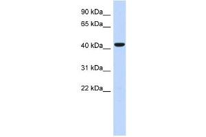 SGMS2 antibody used at 1 ug/ml to detect target protein. (Sphingomyelin Synthase 2 抗体  (N-Term))