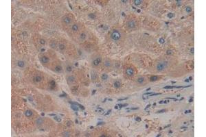 Detection of HPR in Human Liver Tissue using Polyclonal Antibody to Haptoglobin Related Protein (HPR) (HPR 抗体  (AA 70-332))