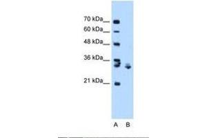 Image no. 1 for anti-X-Box Binding Protein 1 (XBP1) (C-Term) antibody (ABIN6737841) (XBP1 抗体  (C-Term))