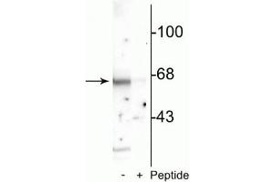 Western blot of rat cortical lysate showing specific immunolabeling of the ~65 kDa Munc-18 protein phosphorylated at Ser513 in the first lane (-). (STXBP2 抗体  (pSer513))
