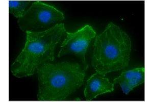 ICC/IF analysis of CASQ2 in HeLa cells line, stained with DAPI (Blue) for nucleus staining and monoclonal anti-human CASQ2 antibody (1:100) with goat anti-mouse IgG-Alexa fluor 488 conjugate (Green). (CASQ2 抗体)