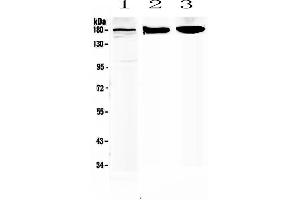 Western blot analysis of SUR1 using anti-SUR1 antibody . (ABCC8 抗体)