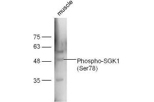 Mouse muscle lysates probed with Rabbit Anti-SGK1 (Ser78) Polyclonal Antibody, Unconjugated  at 1:5000 for 90 min at 37˚C. (SGK1 抗体  (pSer78))