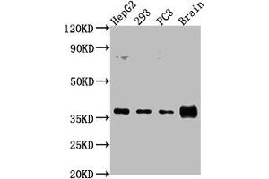 Western Blot Positive WB detected in: HepG2 whole cell lysate, 293 whole cell lysate, PC3 whole cell lysate, Rat brain tissue All lanes: RFNG antibody at 1:2000 Secondary Goat polyclonal to rabbit IgG at 1/50000 dilution Predicted band size: 37 kDa Observed band size: 37 kDa