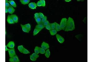 Immunofluorescence staining of Hela cells with ABIN7157400 at 1:100, counter-stained with DAPI. (Keratin 2 抗体  (AA 207-424))