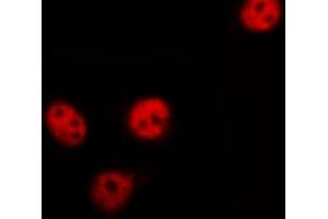 Immunofluorescence (fixed cells) (IF/ICC) image for anti-ELK1, Member of ETS Oncogene Family (ELK1) (pSer389) antibody (ABIN6256309)