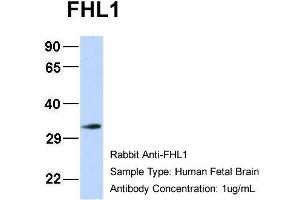 Host: Rabbit Target Name: FHL1 Sample Type: Human Fetal Brain Antibody Dilution: 1. (FHL1 抗体  (N-Term))