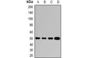 Western blot analysis of Ataxin 3 expression in Jurkat (A), A549 (B), mouse brain (C), mouse liver (D) whole cell lysates. (Ataxin 3 抗体)