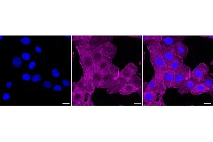 Immunocytochemical staining of HT- cells with MLD antibody (ABIN7799509), 1:1,000). (Recombinant MBP 抗体)