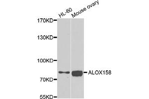 Western blot analysis of extracts of various cell lines, using ALOX15B antibody. (ALOX15B 抗体)