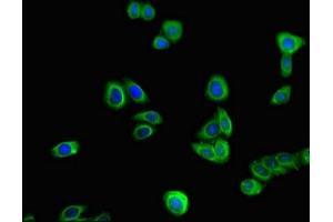 Immunofluorescence (IF) image for anti-Torsin Family 1, Member A (Torsin A) (TOR1A) (AA 88-125) antibody (ABIN7172305)