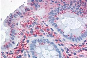 Human Colon: Formalin-Fixed, Paraffin-Embedded (FFPE) (SLC1A5 抗体  (Internal Region))