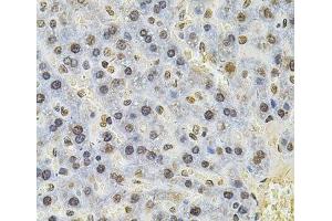 Immunohistochemistry of paraffin-embedded Rat liver using PSMC3 Polyclonal Antibody at dilution of 1:100 (40x lens). (PSMC3 抗体)
