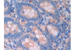 Detection of LCAT in Rat Small intestine Tissue using Polyclonal Antibody to Lecithin Cholesterol Acyltransferase (LCAT) (LCAT 抗体  (AA 41-210))