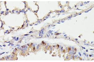 Immunohistochemistry of paraffin-embedded Mouse lung using CDC23 Polyclonal Antibody at dilution of 1:100 (40x lens). (CDC23 抗体)