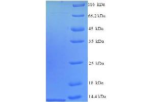 SDS-PAGE (SDS) image for Chemokine (C-C Motif) Ligand 12 (Ccl12) (AA 23-104) protein (His tag) (ABIN5712658)