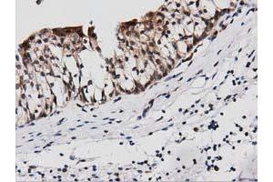 Immunohistochemical staining of paraffin-embedded Human liver tissue using anti-PEPD mouse monoclonal antibody. (PEPD 抗体)