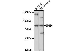 Western blot analysis of extracts of various cell lines, using ITGB6 antibody (ABIN7267932) at 1:1000 dilution. (ITGB6 抗体  (AA 732-788))