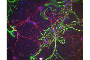Immunofluorescence of rat cortical neurons and glia showing NF-H staining (red). (NEFH 抗体)