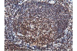 Image no. 3 for anti-RuvB-Like 2 (E. Coli) (RUVBL2) (AA 113-370) antibody (ABIN1490850)