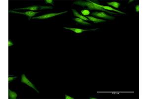 Immunofluorescence of purified MaxPab antibody to DFFA on HeLa cell.
