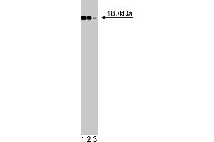 Western Blotting (WB) image for anti-Insulin Receptor Substrate 1 (IRS1) (AA 1131-1234) antibody (ABIN968515) (IRS1 抗体  (AA 1131-1234))