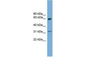 Image no. 1 for anti-Protein Inhibitor of Activated STAT, 2 (PIAS2) (AA 81-130) antibody (ABIN6744670) (PIAS2 抗体  (AA 81-130))