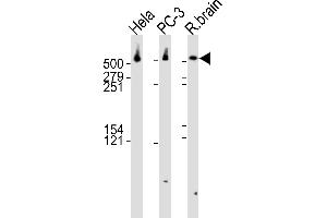 Western blot analysis of lysates from Hela, PC-3 cell line and rat brain tissue lysate(from left to right), using DYNC1H1 Antibody (C-term) (ABIN6242986 and ABIN6577559). (DYNC1H1 抗体  (C-Term))
