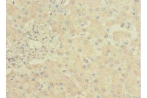 Immunohistochemistry of paraffin-embedded human liver tissue using ABIN7158162 at dilution of 1:100 (LRRC31 抗体  (AA 1-300))