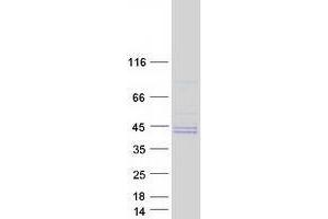 Validation with Western Blot