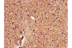 Immunohistochemistry of paraffin-embedded human brain tissue using ABIN7168341 at dilution of 1:100 (RBM38 抗体  (AA 1-239))