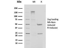 SDS-PAGE (SDS) image for anti-Cystatin A (Stefin A) (CSTA) antibody (ABIN6939196)