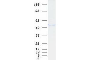 Western Blotting (WB) image for Filamin Binding LIM Protein 1 (FBLIM1) (Transcript Variant 1) protein (Myc-DYKDDDDK Tag) (ABIN2720916)