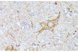 Immunohistochemistry of paraffin-embedded Mouse spinal cord using TBCA Polyclonal Antibody at dilution of 1:100 (40x lens). (TBCA 抗体)