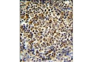 Immunohistochemistry (Paraffin-embedded Sections) (IHC (p)) image for anti-Killer Cell Immunoglobulin-Like Receptor, Two Domains, Long Cytoplasmic Tail, 5B (KIR2DL5B) (AA 264-290) antibody (ABIN652855)