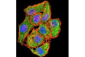 Immunofluorescence (IF) image for anti-Mitogen-Activated Protein Kinase Kinase 3 (MAP2K3) (AA 1-138) antibody (ABIN5542528)