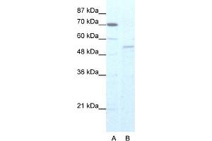 WB Suggested Anti-ZNF665 Antibody Titration:  5. (ZNF665 抗体  (N-Term))