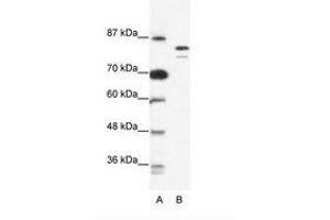 Image no. 1 for anti-Minichromosome Maintenance Deficient 8 (MCM8) (AA 144-193) antibody (ABIN203257) (MCM8 抗体  (AA 144-193))