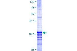 Image no. 1 for TMEM189-UBE2V1 Readthrough (TMEM189-UBE2V1) (AA 94-164) protein (GST tag) (ABIN1322999) (TMEM189-UBE2V1 Protein (AA 94-164) (GST tag))