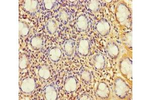 Immunohistochemistry of paraffin-embedded human colon tissue using ABIN7174792 at dilution of 1:100 (C1ORF53 抗体  (AA 1-145))