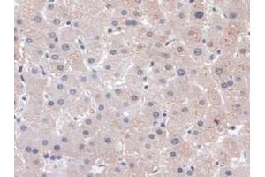 Detection of PLCB1 in Human Liver Tissue using Polyclonal Antibody to Phospholipase C Beta 1 (PLCB1) (Phospholipase C beta 1 抗体  (AA 316-476))
