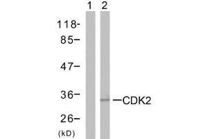Western blot analysis of the extracts from A2780 cells using CDK2 (Ab-160) antibody (E021111). (CDK2 抗体)
